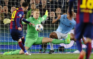 Có 10 pha cứu thua, Joe Hart 'cân' cả hàng công Barcelona