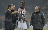 'Không Pogba, không sao'