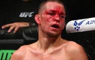 Nate Diaz trở lại hạng cân trên 70kg tại UFC 189