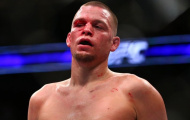 Nate Diaz tức giận vì bị ép đấu cùng Matt Brown