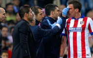 Hậu derby, Mandzukic đổ máu, Simeone bảo vệ trọng tài