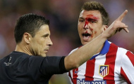 Mandzukic đổ máu vì Ramos, đo ván vì Carvajal