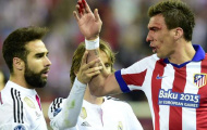Mandzukic làm sáng tỏ nghi án cắn người của Carvajal