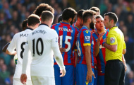 Pardew tố trọng tài thiên vị 11m cho Man United