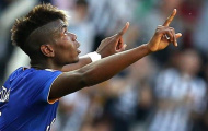 Pogba không phải là Messi hay C.Ronaldo