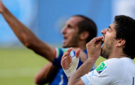 Chiellini không để bụng vụ 'cắn người' của Suarez