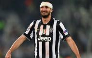 Juventus gặp họa trước thềm CK Champions League