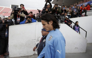 Copa America 2015: Uruguay trước nguy cơ mất họng súng Cavani