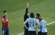 Chùm ảnh: Cavani bị đuổi, Uruguay thành cựu vương Copa America