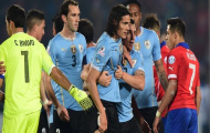 Video: Những pha bóng xấu xí tại Copa America