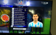 Gặp Colombia, Aguero quay mặt đối đầu với Argentina