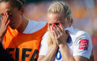 Video: Tình huống đen đủi nhất tại World Cup nữ 2015