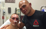 UFC 189: Sau trận tử chiến, Lawler và MacDonald cùng vào bệnh viện tự sướng