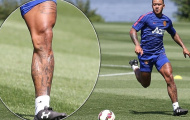 Tân binh M.U khoe bắp đùi “khủng” không kém C.Ronaldo