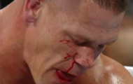 John Cena bị bạn diễn làm gãy mũi trên võ đài