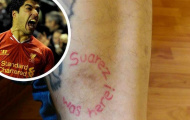 Bị cắn vào chân, bảo vệ quán rượu bất ngờ đổ lỗi cho… Luis Suarez