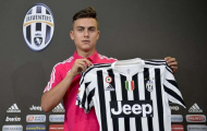 Top 5 cầu thủ đáng chú ý nhất ở Serie A mùa giải 2015/16