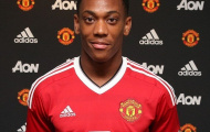 Góc Trần Minh Chiến: Van Gaal phải cân nhắc khi dùng Anthony Martial