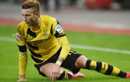 Trước giờ xuất trận, Dortmund lại mất họng súng chủ lực