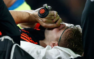 Gãy chân ghê rợn, Luke Shaw cần bác sĩ tâm lý