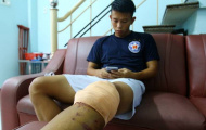 Anh Khoa bàng hoàng, chán nản với mức độ chấn thương