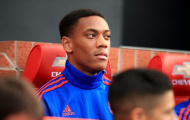 Anthony Martial: Cậu nhóc có khuôn mặt “sát thủ”