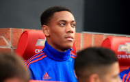 Anthony Martial: Cậu nhóc có khuôn mặt “sát thủ”