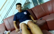 Chiều nay 30/9, Anh Khoa sang Singapore đại phẫu