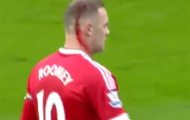 Video: Tình huống Rooney chảy máu đầu trong trận Derby
