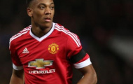 5 bất ngờ lớn nhất của Premier League 2015/16