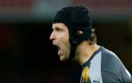Cech muốn... gỡ mũ bảo hiểm