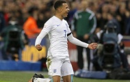 Dele Alli: Cần bịt tai và che mắt lại