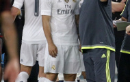 Benitez đang hủy hoại James Rodriquez?