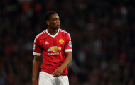 Anthony Martial: Đừng đổ áp lực lên một cậu nhóc