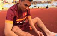 Tiền vệ U23 Việt Nam chấn thương sau cú vào bóng của JFL Selection