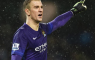 Joe Hart: 'Man City phải cải thiện 1 triệu phần trăm để hạ Arsenal'