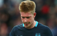 Sốc: Man City mất De Bruyne tới tận tháng 3