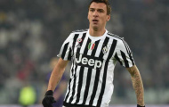 Juventus thiệt quân nặng trước trận gặp Bayern Munich