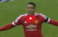 Video: Màn trình diễn của Anthony Martial vs Stoke