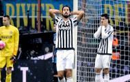 Juventus mất trụ cột trước trận gặp Bologna
