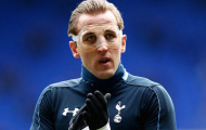 Harry Kane sa sút vì... mặt nạ