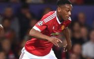 Người Pháp choáng váng vì Martial