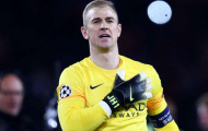Joe Hart trách móc Fernando sau sai lầm tai hại