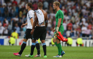 Video: Joe Hart làm nản lòng các chân sút Real Madrid