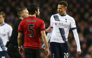 Dele Alli bị treo giò 3 trận: Dấu chấm hết cho Spurs!?