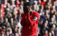 Juergen Klopp lý giải nguyên nhân không dùng Sturridge