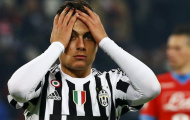 Juve không cho phép Dybala về dự Olympic
