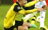CHÍNH THỨC: Marco Reus bị loại khỏi EURO