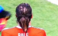 Tóc rụng nhanh, Bale đang bị hói đầu nặng