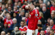MU với Wayne Rooney: Đau một lần rồi thôi